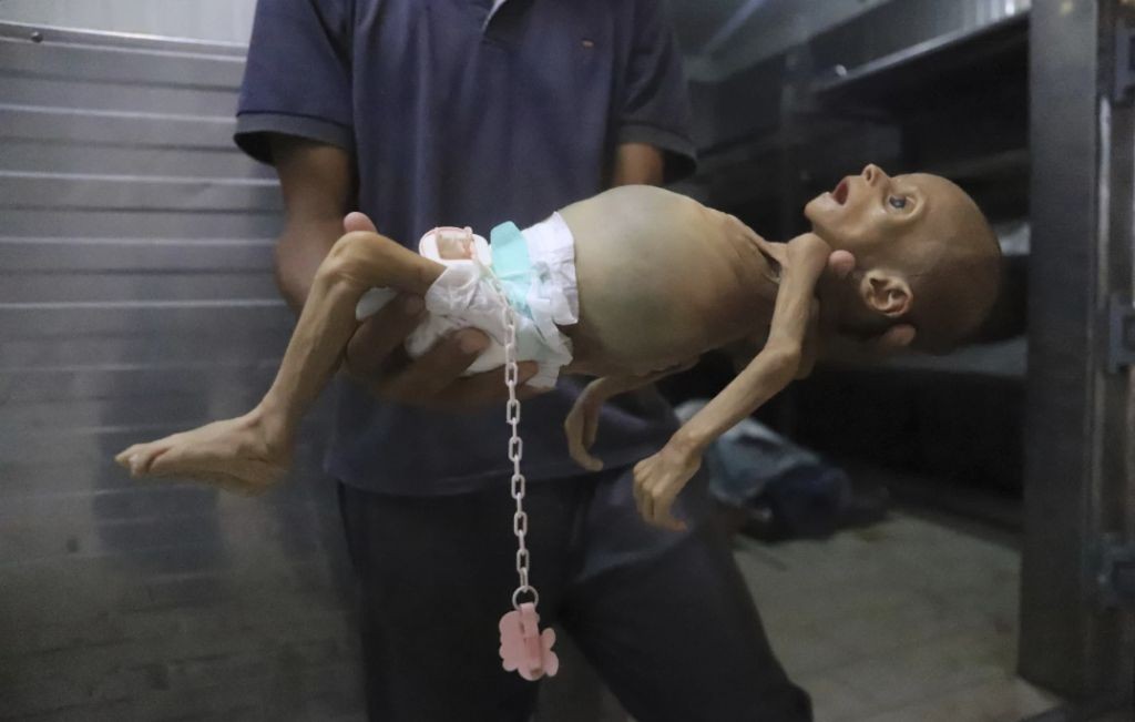 PBB: Israel Sengaja Bunuh Anak-Anak Gaza