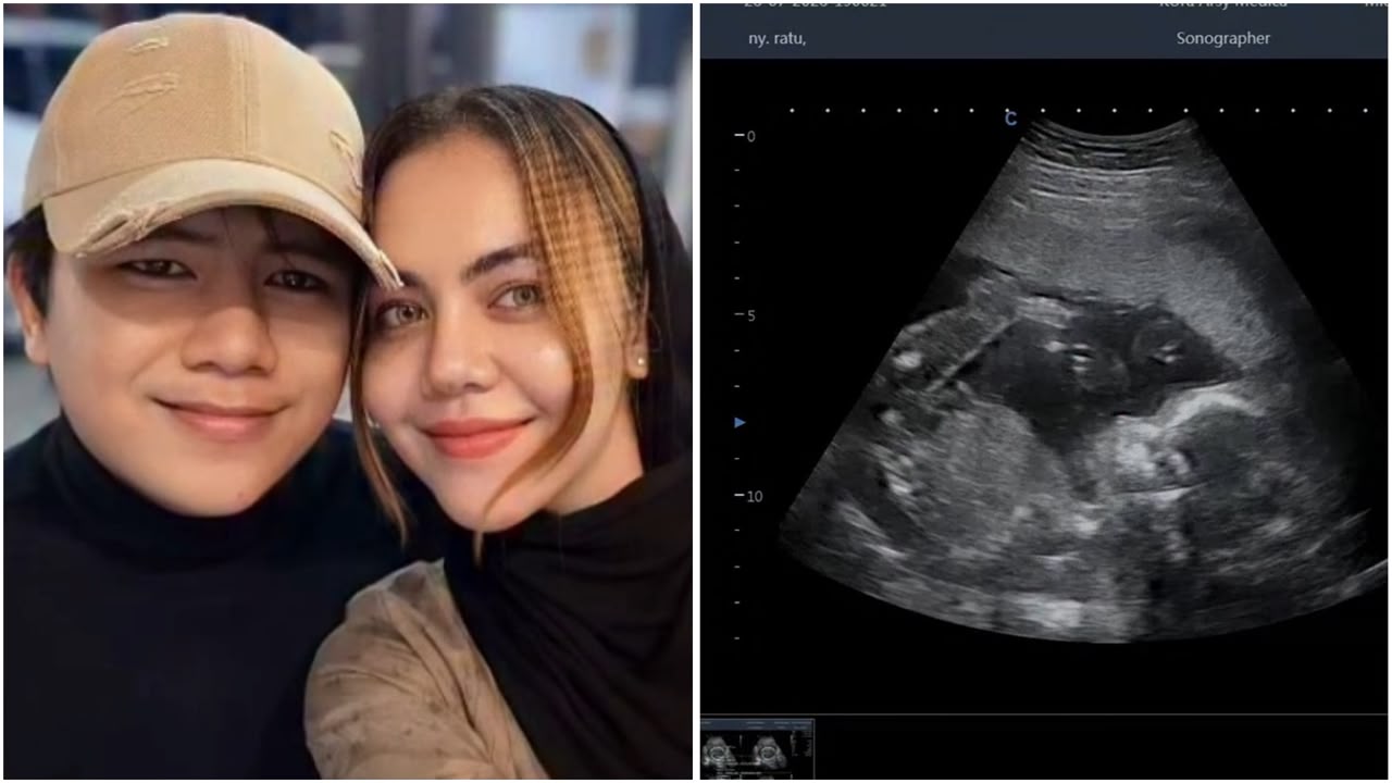 Ratu Rizky Nabila Umumkan Segera Melahirkan Anak Pesulap Merah: Mohon Doa Terbaik