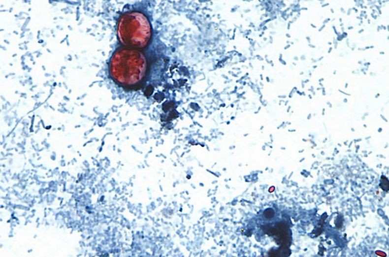 AS Dilanda Wabah Virus Siklosporiasis, Lebih dari 10.000 Kasus 2 Orang Tewas