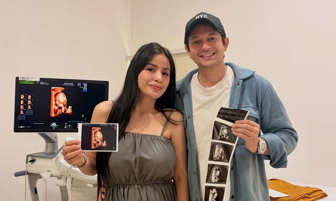 Akibat Abu Vulkanik, Andrew Andika Batal Ajak Istri Babymoon ke Bali