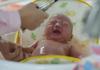 Bayi di China Positif Virus Korona 30 Jam Setelah Lahir, Jadi Pasien Termuda yang Terinfeksi