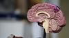 Ilmuwan Bikin Neuron Buatan dan Biologis Berkomunikasi lewat Internet