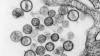 Hantavirus Hebohkan Dunia di Tengah Pandemi Virus Corona