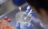 Vaksin Virus Corona Bisa Tersedia September 2020, Hasil Kerja Keras Universitas Oxford