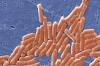 Kasus Covid-19 Masih Tinggi, Lebih dari 400 Orang di AS Malah Terinfeksi Salmonella