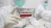PT Freeport Sumbangkan 500 Unit Alat Rapid Test Antigen ke Dinkes Mimika