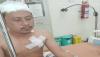 Polisi Buru Pelaku Begal Sopir Taksi Online yang Nyaris Tewas di Palembang