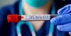 Penelitian Obat Covid-19 Niclosamide di Korea Mulai Uji Klinis
