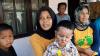 Main Petasan, Wajah Balita di Tasikmalaya Hangus Terbakar