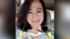 Ngeri, Perawat Cantik di Malang Ini Disiram Cairan Lalu Dibakar Pria Tak Dikenal 