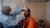 Tak Kalah Bahaya dari Covid, 28.000 Warga India Terpapar Jamur Mucormycosis Mematikan