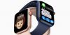 Apple Watch Masa Depan Bakal Bisa Lacak Tingkat Hidrasi Pengguna
