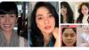 Ini Penampilan Artis Sebelum dan Sesudah Tanam Benang, Lesti Kejora Beda Banget Bikin Pangling