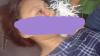 Viral Wanita Cantik Manado Kena Panah Wayer di Pipi saat Keluar Cari Makan   