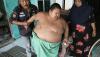 Potret Penderita Obesitas Asal Bekasi, Umur 11 Tahun Berat Badan 115 Kg