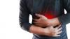 8 Cara Mengatasi Asam Lambung dengan Cepat
