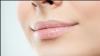 4 Cara Mengatasi Bibir Kering, Salah Satunya dengan Minyak Kelapa