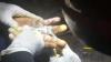 Kasus Terjepit Cincin Sering Terjadi di Garut, Paling Ngeri Jari Membusuk