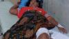 Pasutri di Tabalong Diserang Beruang Liar, Kaki Digigit 