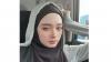 5 Artis Cantik yang Makin Sukses usai Berpisah dengan Pasangan, Nomor 4 Punya Tambang Batu Bara