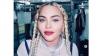 Madonna Batal Konser Gara-Gara Infeksi Bakteri, Kini Terbaring di ICU