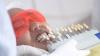Tips Merawat Gigi Setelah Perawatan Bleaching
