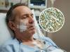 Mengerikan! Pria Ini Sakit Parah akibat Virus Misterius, Kasus Pertama di Dunia