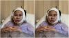 Muka Denise Chariesta Mendadak Bengkak dan Sulit Bicara, Ini Faktanya!
