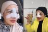 Elly Sugigi Pamer Operasi Hidung, Ungkap Ingin Hidup seperti Manusia Sempurna