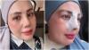 Elly Sugigi Habiskan Rp65 Juta untuk Oplas Hidung dan Mata, Akui Lelah Dihina!