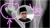 Aldi Taher Khawatir Pengapuran Tulang yang Diidapnya Efek dari Kemoterapi Kanker