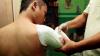Melihat Proses Pembuatan Kaki dan Tangan Palsu - Bagian 4