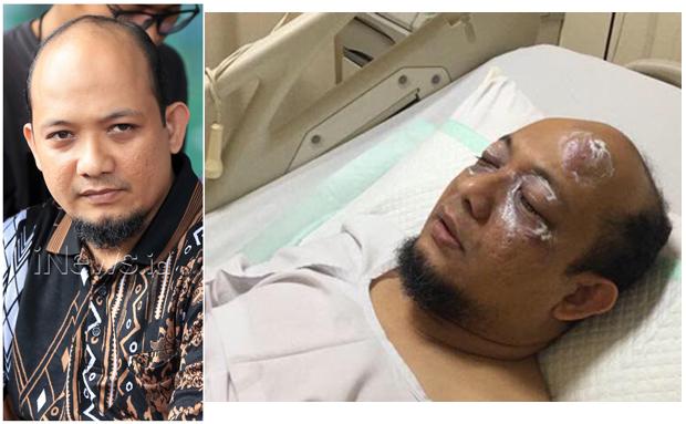 Kompolnas Sebut Kasus Penyiraman Air Keras Novel Rumit 