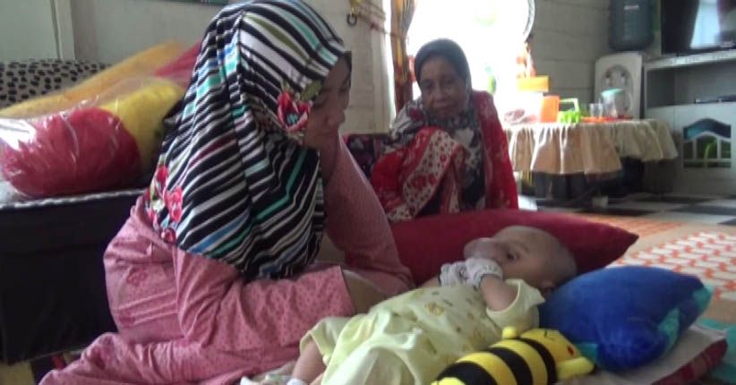 Bayi Penderita Hydrocephalus Ditolak Rawat Inap di RSUD Kalsel