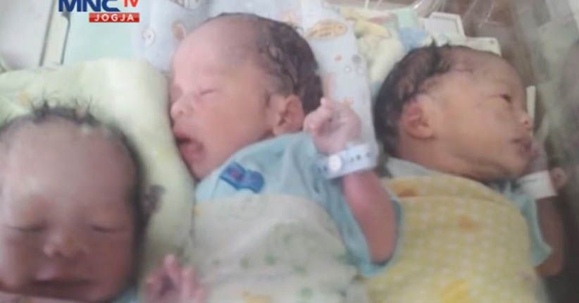 Bayi Kembar 3 Lahir Selamat di Kebumen lewat Operasi Caesar