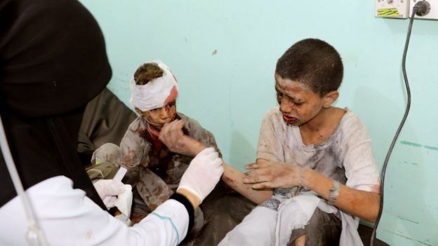 PBB Kutuk Serangan Koalisi Saudi yang Tewaskan Puluhan Bocah di Yaman