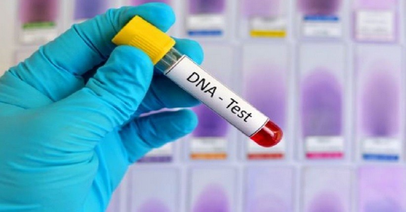 Pentingnya Cek Kesehatan lewat Tes DNA, Bisa Ketahui Kondisi Kulit dan Nutrisi