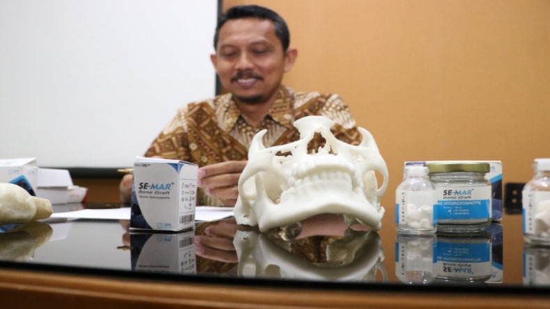 Dosen UNS Kembangkan Material Pengganti Tulang Rusak dari Tulang Sapi
