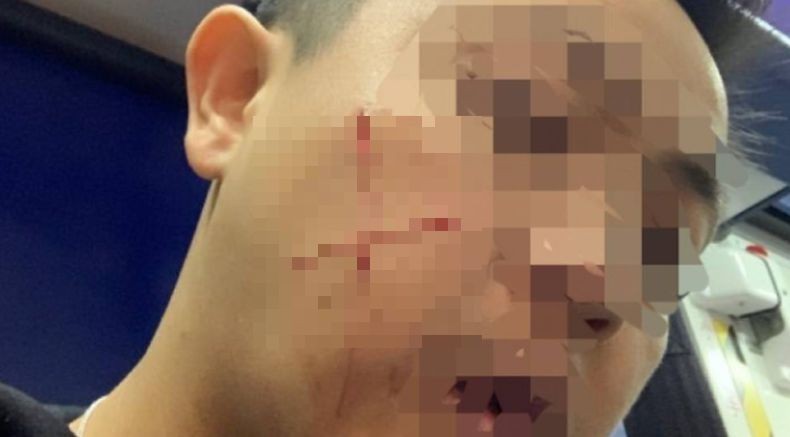 Polisi Hong Kong Disayat Pipinya Membentuk Tanda Silang