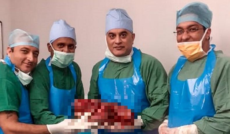 Rekor, Dokter di India Angkat Ginjal Seberat 7,4 Kg dari Tubuh Pasien Pria