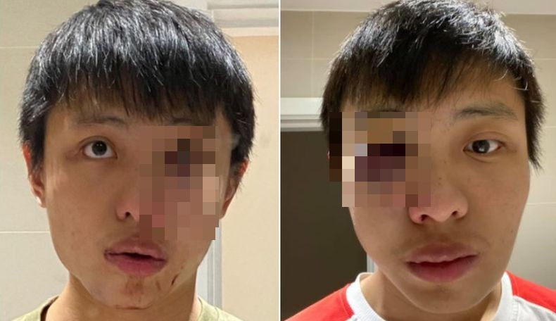 Viral Mahasiswa Singapura Babak Belur Dikeroyok di Inggris Terkait Rasisme Virus Korona