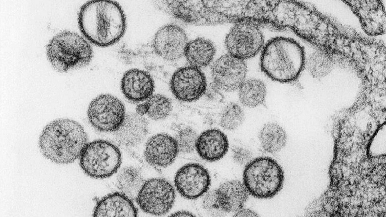Hantavirus Hebohkan Dunia di Tengah Pandemi Virus Corona