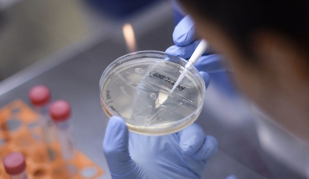 Lagi, Vaksin Virus Corona Diuji Coba pada Manusia