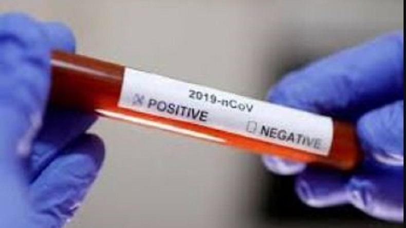 Update 27 Juni: Positif Covid-19 Jateng Tambah 197 Jadi 3.294 Orang, Tertinggi Ketiga Nasional
