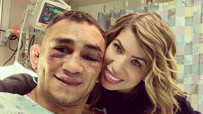 Muka Bonyok, Tony Ferguson Malah Asyik Joget di Rumah Sakit 