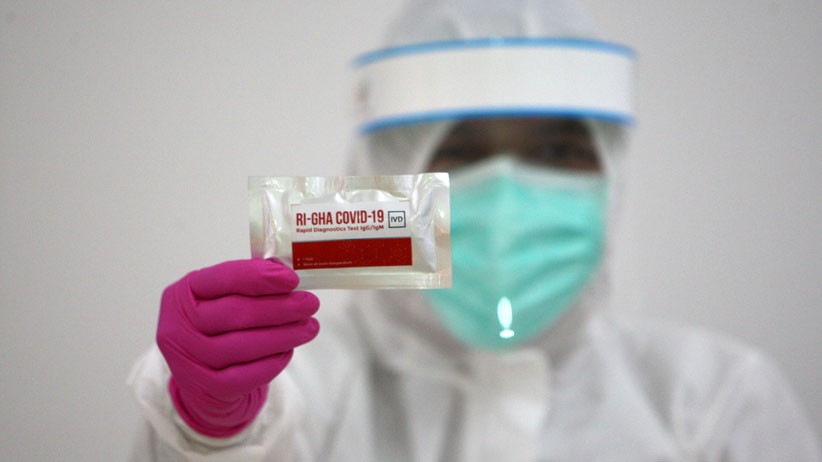 2.513 Warga Sulut Reaktif Covid-19 Hasil Rapid Test