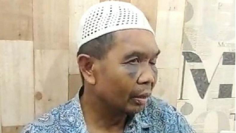 Polisi Aniaya Saksi hingga Babak Belur, Dipaksa Ngaku sebagai Pelaku Pembunuhan