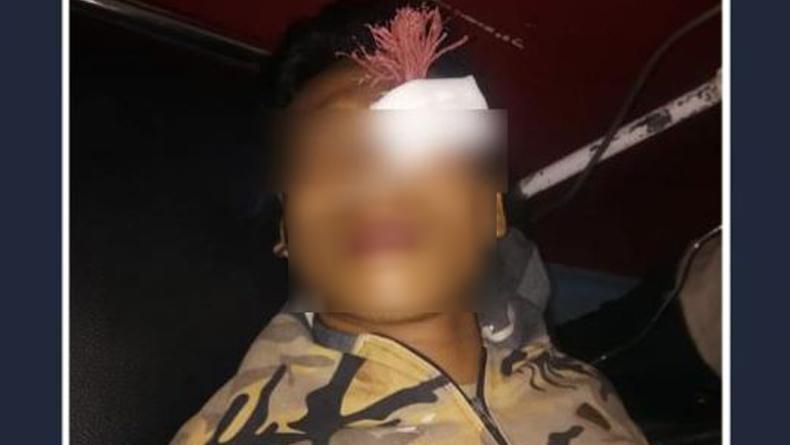 Ngeri, Busur Panah Tertancap di Mata Kiri Remaja di Makassar