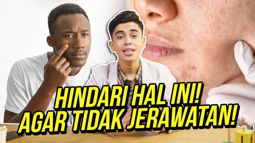 Ayman Alatas Kasih Tips untuk Terhindar dari Jerawat Membandel