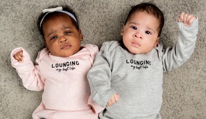 Ajaib, Bayi Kembar Ini Lahir dengan Warna Kulit Berbeda